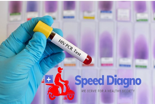 HIV (I) PCR REPORT - QUANTITATIVE