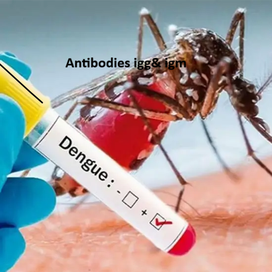 DENGUE IgM & IgG Antibodies (ELISA)