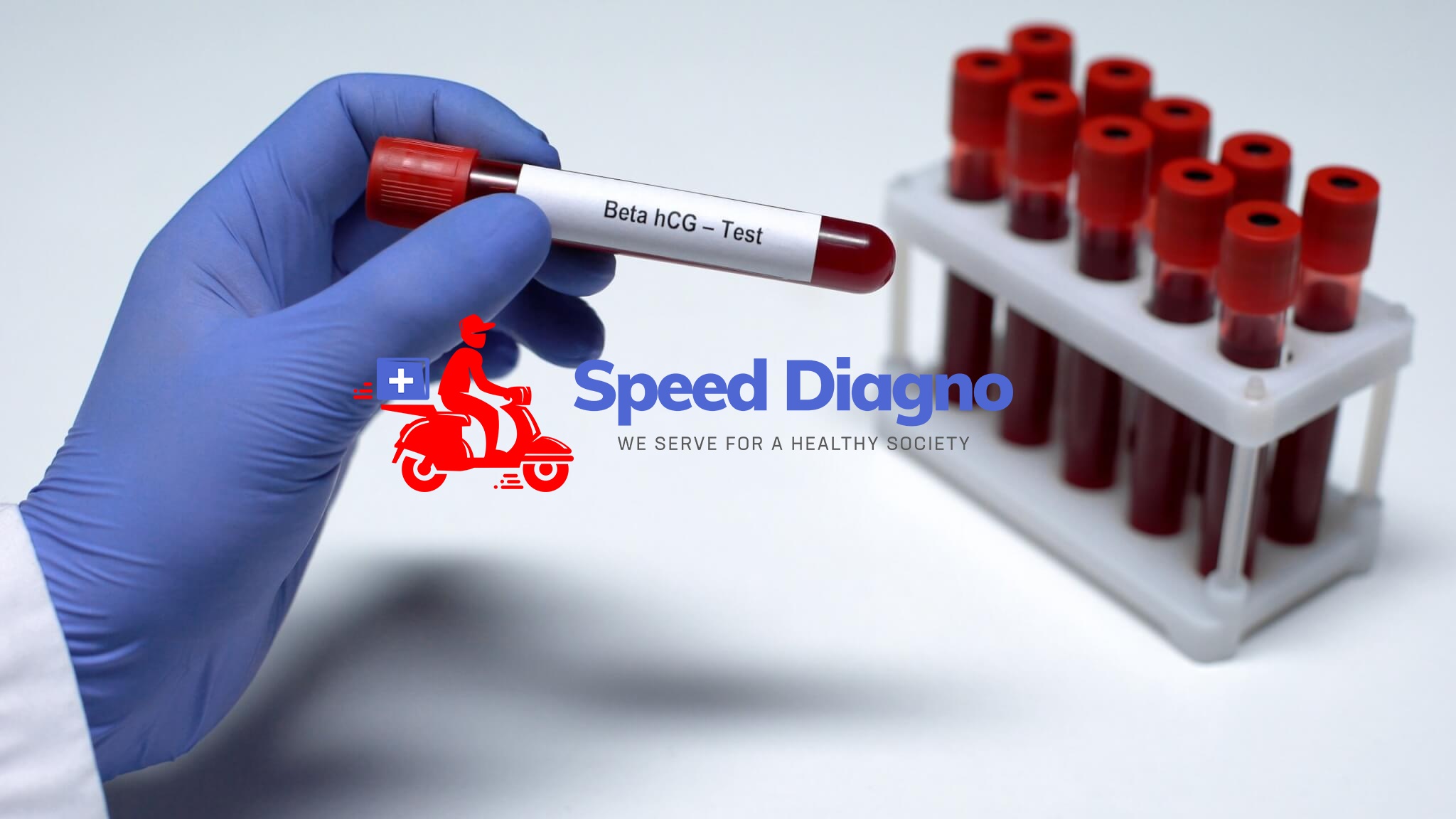 Beta Human Chorionic Gonodotropin Hormone(BETA HCG)