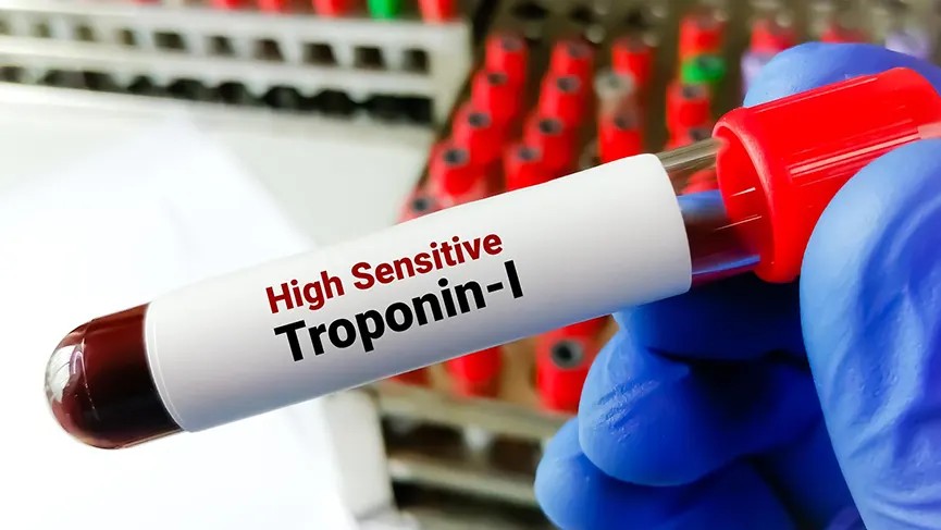 TROPONIN - I (Quantity)