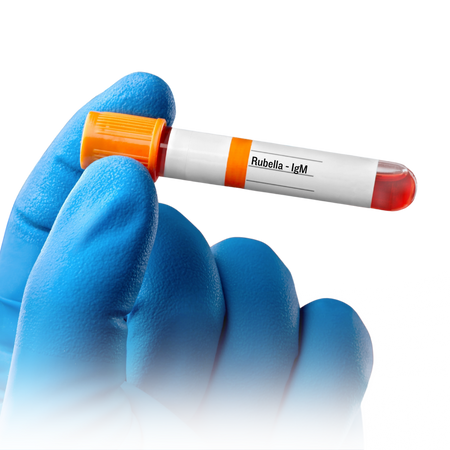 Rubella (German Measles)- IgM